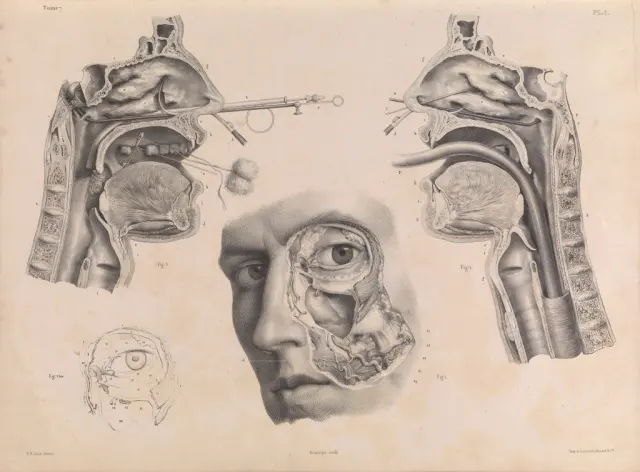 Traité complet de l'anatomie de